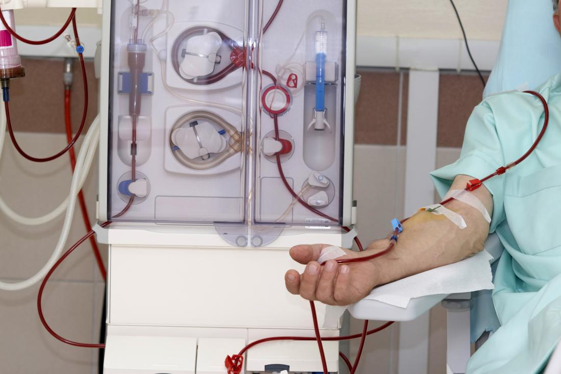 kidneys dialysis